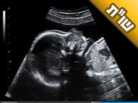 אשתי בחודש השני להיריון. על אילו דברים צריכים להקפיד בתקופה הזו? אשתי בחודש השני להיריון. על אילו דברים צריכים להקפיד בתקופה הזו?