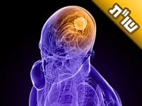 האם אפשר להתפלל עבור חולה אנוש למרות שהרופאים כבר הרימו ידיים?